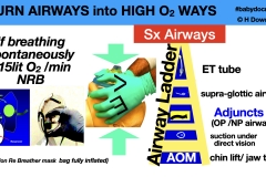 make-airways-better