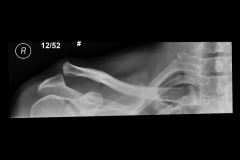 acj13