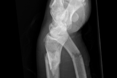 wrist9